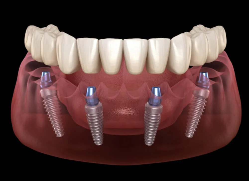 shutterstock dental